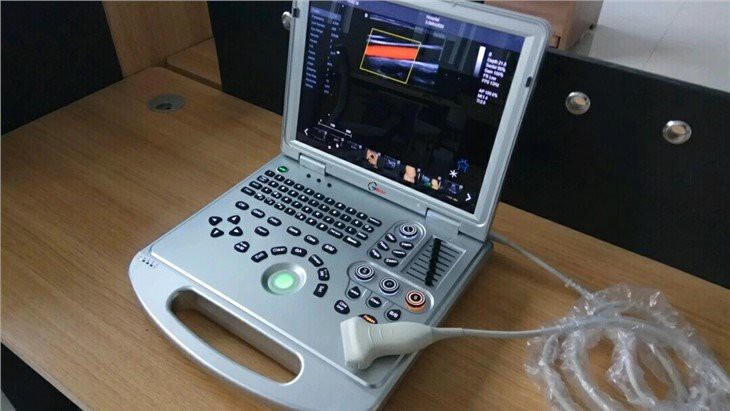 Notebook Full Digital Ultrasound Scanner