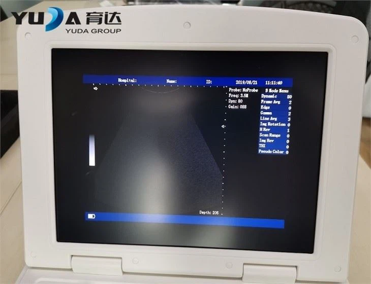 Traditional Trolley Ultrasound Machine
