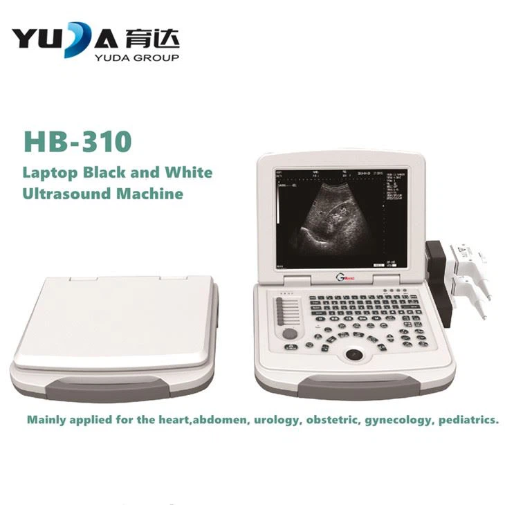 Traditional Trolley Ultrasound Machine
