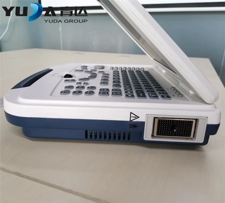 Traditional Trolley Ultrasound Machine