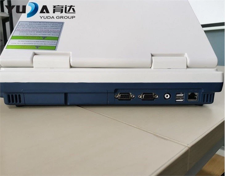 Traditional Trolley Ultrasound Machine